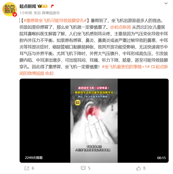 坐飞机害怕的事再+1!重感冒坐飞机可能导致鼓膜穿孔