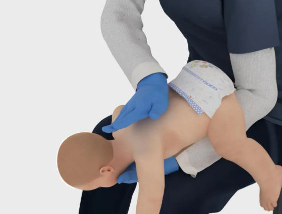 海姆立克急救法更新了:先拍5次背 再做“剪刀石头布”