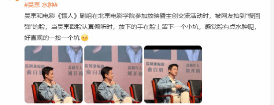 “吴京水肿”登热搜：脸上一按一个坑