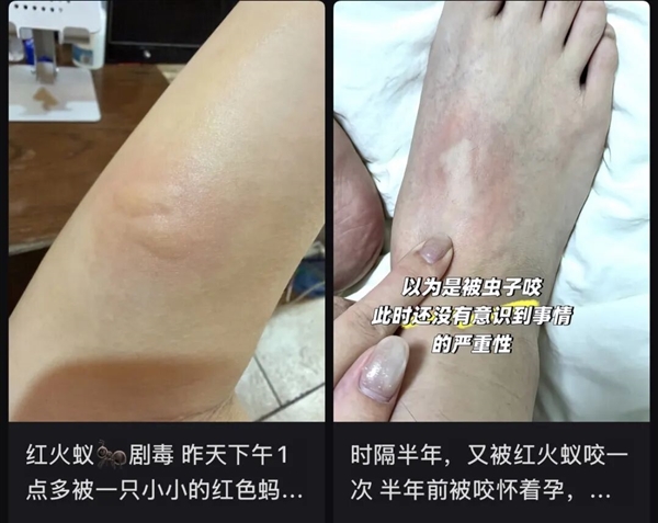 遇到这种小土包千万别踩!有可能丧命
