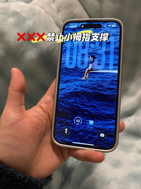 用小拇指做手机支架的受害者出现了：手指出现明显凹痕
