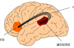 为什么人一紧张就口吃啊！