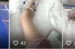 央视曝光断骨增高灰色产业链：女子出国做手术腿部严重感染喷脓
