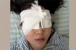 “右眼瞬间失明”！女游客高压水枪伤眼 如何应急处理