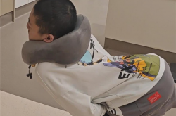 全球首例！4次断骨打开折叠男孩迈出新生第一步