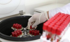 胆红素升高到多少有危险，各种胆红素，都代表了什么？