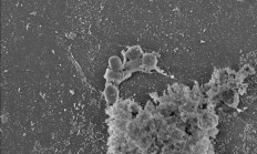 地球有吃塑料的虫子? 为什么我们没把它们发挥光大