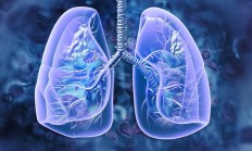 生闷气对身体不好！男子因妻子总抱怨长期生闷气患肺癌