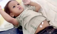 印媒称1岁男童咬死眼镜蛇奇迹生还 网友质疑造神