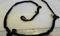 体长55米的绦虫！缩成一团蠕动堪比现实版“毒液”