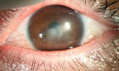 保护眼睛：这5件事再干下去 眼睛真要废了！