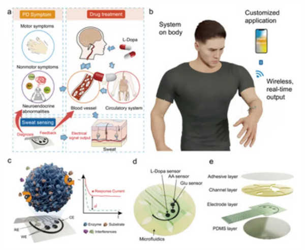 我国开发可穿戴监测系统：为帕金森病早期干预提供可能