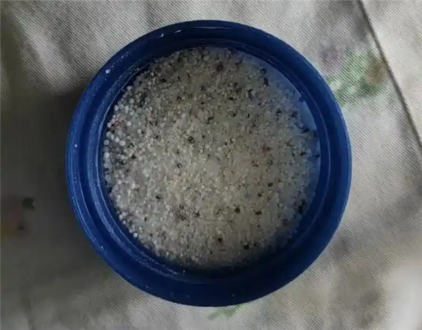 男孩把疏通剂当玩具 双手被灼伤差点不保