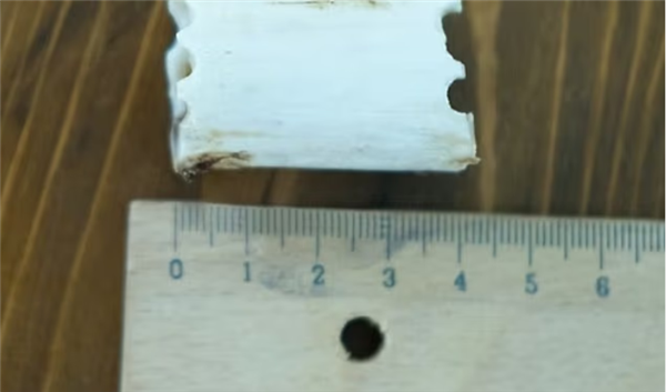 太疯狂！嫌个子太高不好找对象 女子手术切骨变矮