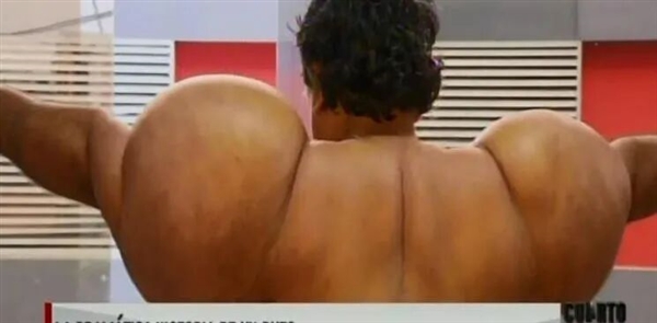 男子潜水氧气管被切断 全身肿胀如大肌霸！11年治疗无果